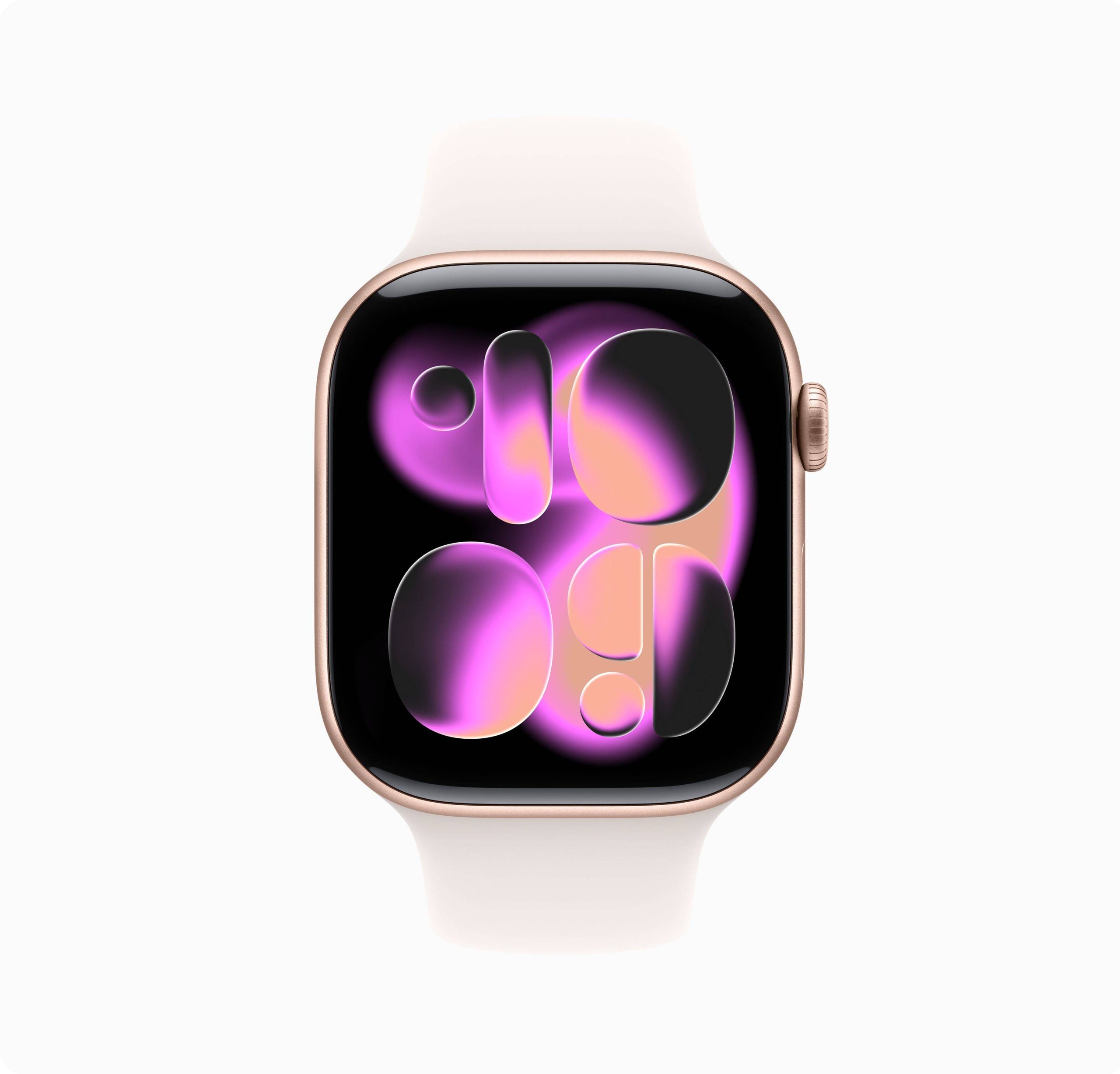 Apple-Watch-11-rose-gold-1-scaled-1.jpg